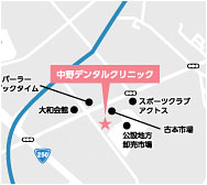 アクセスマップ